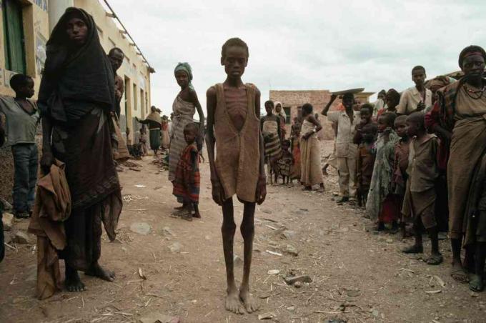 Dėl Somalio pilietinio karo kilusio bado aukos.